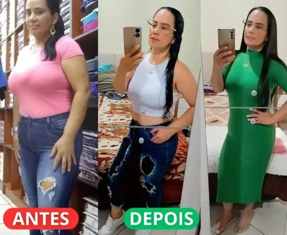 Antes e depois — Fernanda